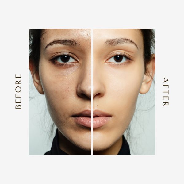 The Ordinary Skin Brightening Niacinamide 10% + Zinc 1% serum 30ml + Glow Natural Glutathione Alpha Arbutin Skin Brightening Cream (50g) + Kashees Eventone High Coverage Liquid Foundation (random Shades) 45ml