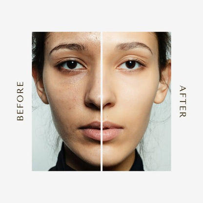 The Ordinary Skin Brightening Niacinamide 10% + Zinc 1% serum 30ml + Glow Natural Glutathione Alpha Arbutin Skin Brightening Cream (50g) + Kashees Eventone High Coverage Liquid Foundation (random Shades) 45ml